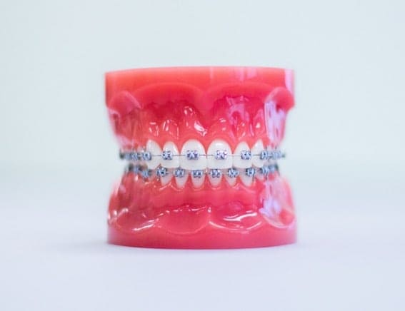 central point braces